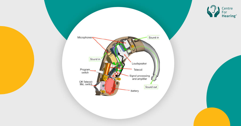 High Investments in R&D and Precise Instrumentation Used in Hearing Aids