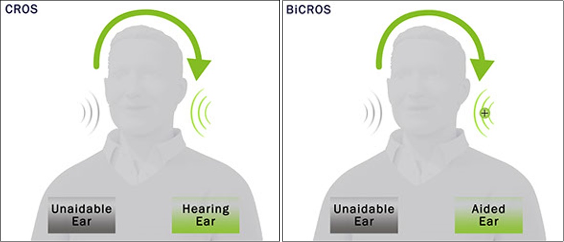 hearing aid picks